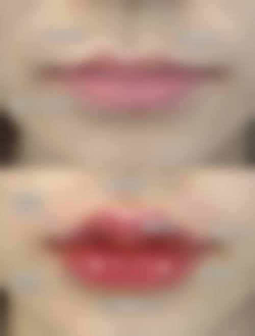 无锡美杜莎医疗美容医院怎么样来院路线