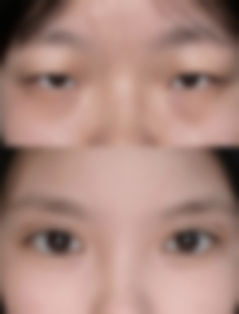 韩国TheBeauty整形医院特色项目及技术优势