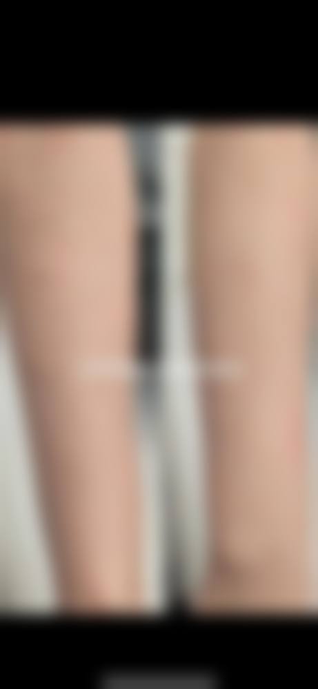 洪剑威：毛发种植与精致五官整形医师