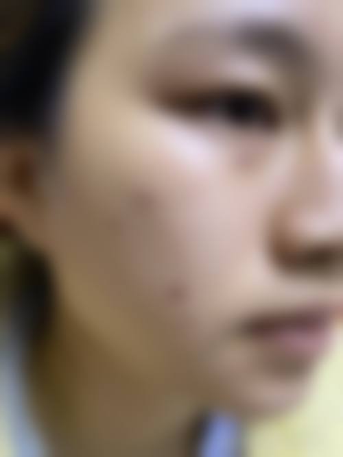 洪剑威：精细化塑形与体态改善骨干医生