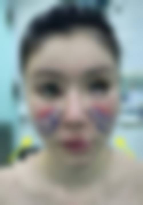 东营中亚医疗美容医院价格收费