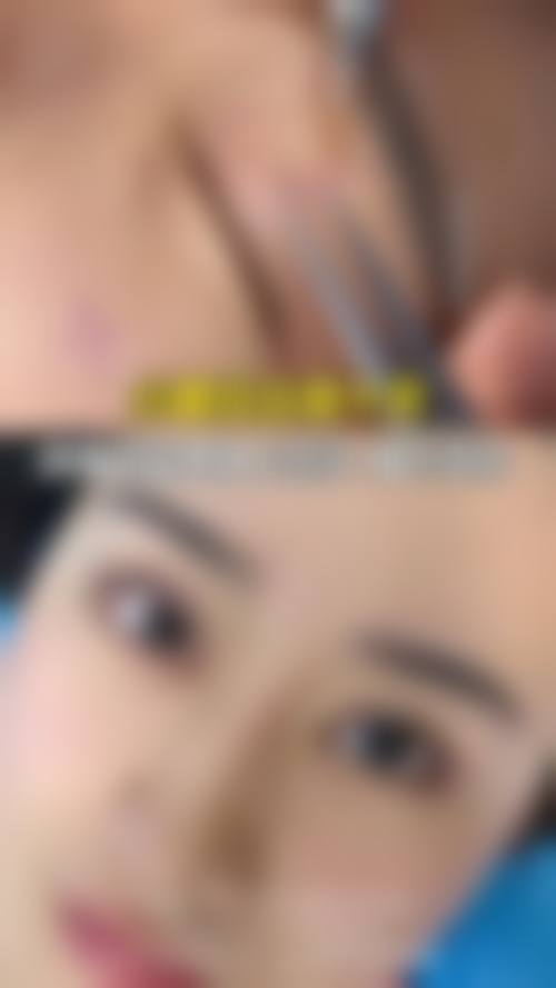 李瑛擅长的特色与常规医美项目全览