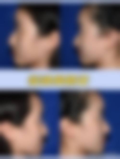 南宁慧美医学美容整形诊所求美者反馈