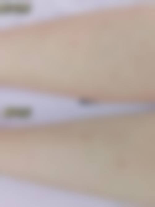 胡晗菲医生坚持个性化医美定制思路