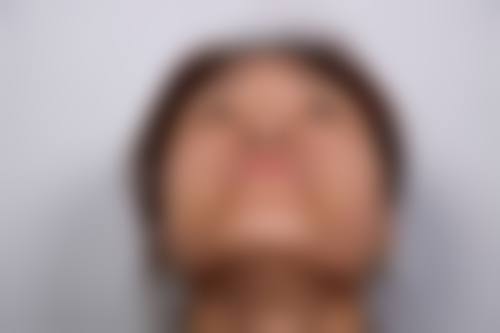 淮北市中医院整形美容专科怎么样求美者反馈