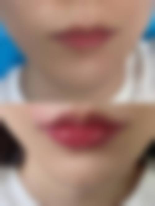 胡晗菲医生依托衡阳美莱精品平台保护诊疗品质