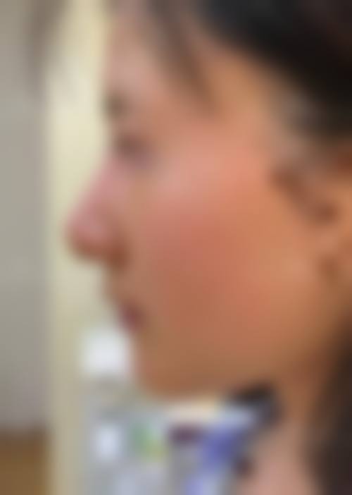 深圳爱上美医疗美容诊所怎么样求美者反馈