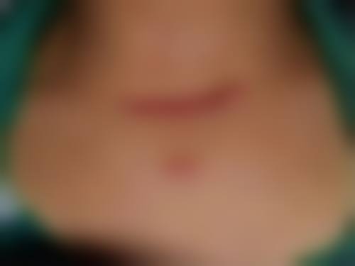 西安韩佳人整形医疗美容医院怎么样价格收费