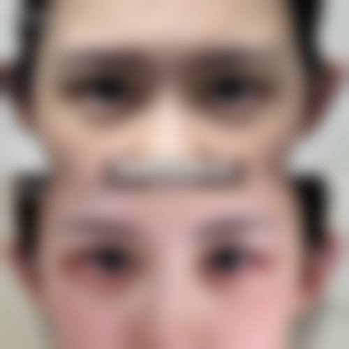 北京海医悦美医疗美容整形医院价格收费