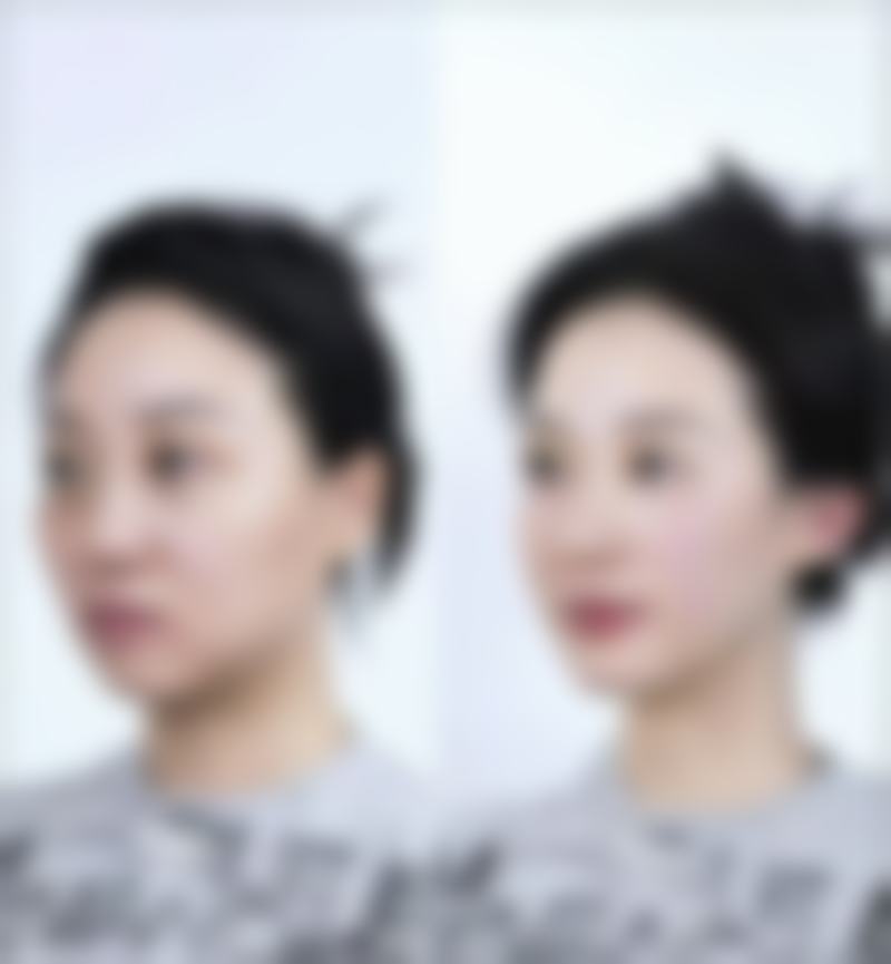 云南昆明彼心美容整形门诊价格收费