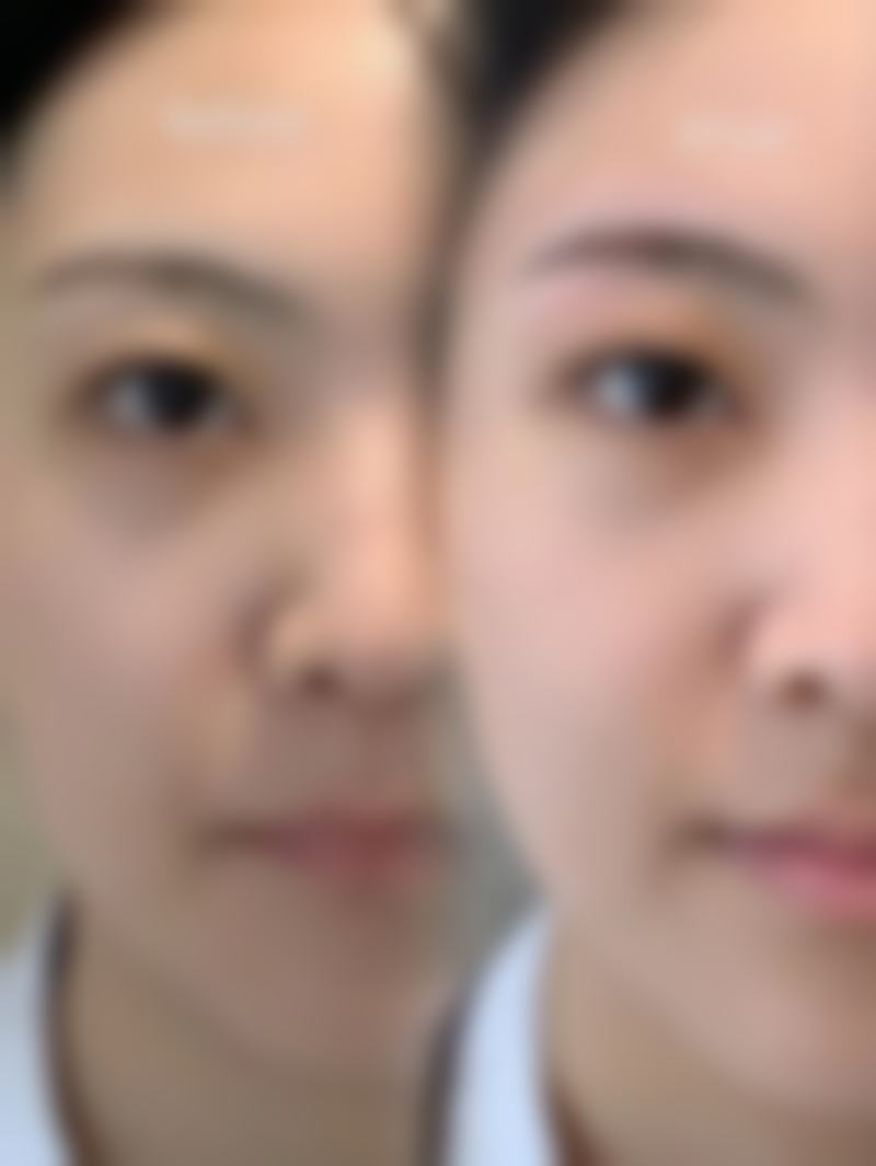 吉首佳影医疗美容诊所求美者反馈