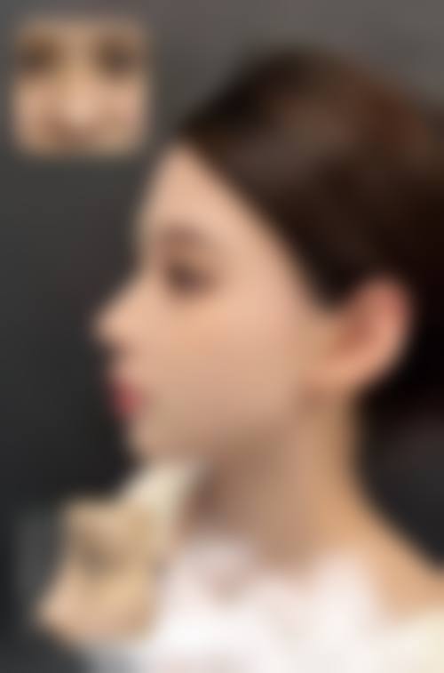 宝鸡时光整形医院求美者反馈