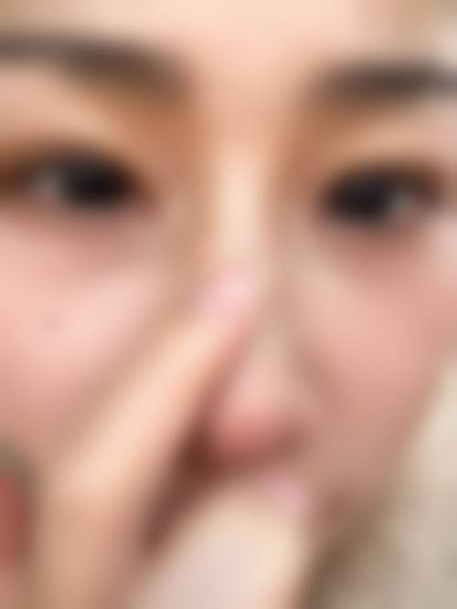 镇江润州瑞丽整形医院价格收费