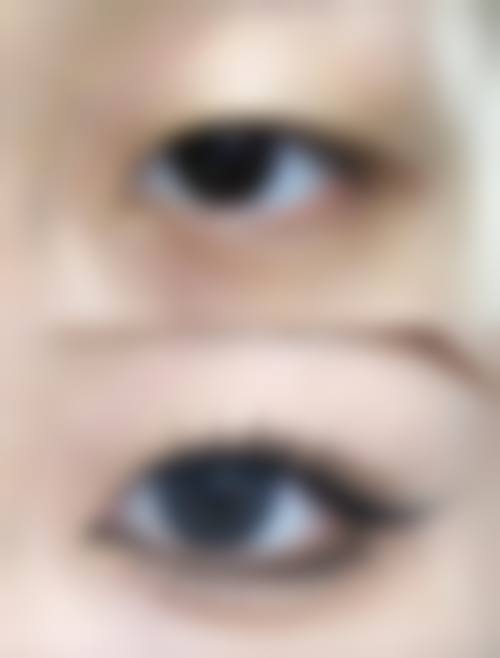 朱巧凤医生主推的特色医美技术