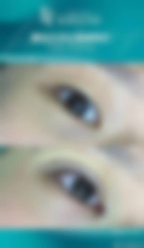 北京大学人民医院(整形外科)怎么样来院路线