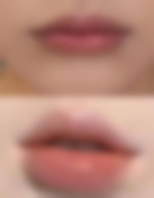 朱巧凤医生的个性化定制诊疗理念