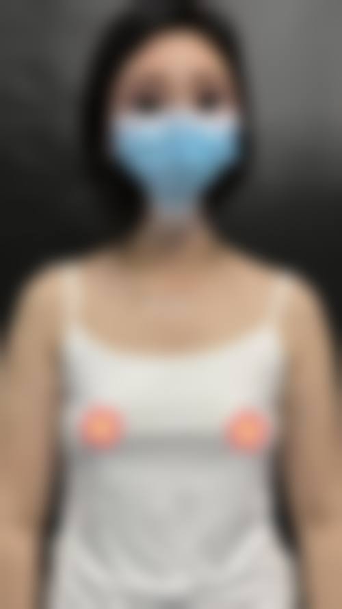 重庆薇琳医疗美容整形医院价格收费