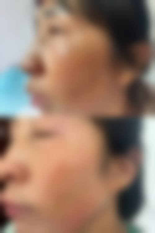 河北邯郸曲胜星范医疗美容门诊部怎么样价格收费