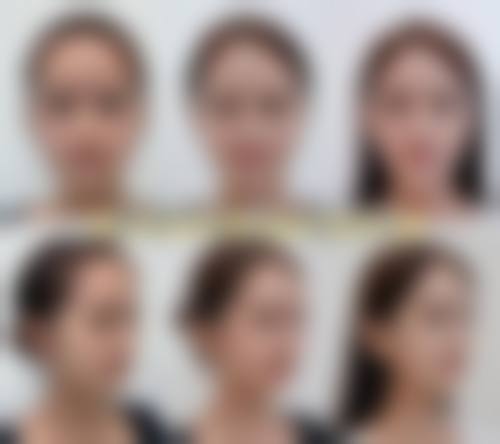 广州伊丽莎白医疗美容医院怎么样特色项目及技术优势