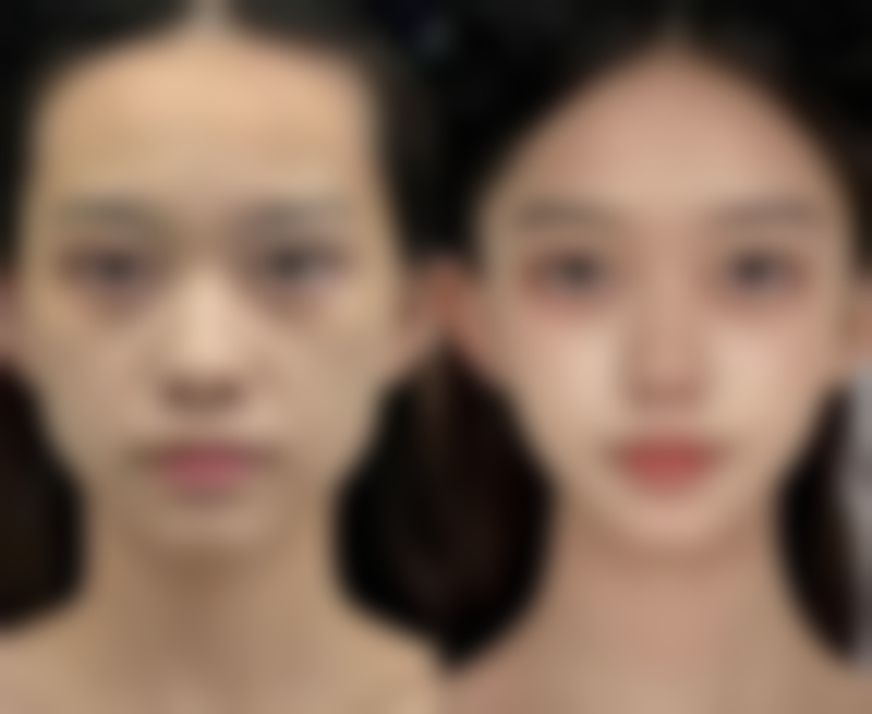 镇江润州瑞丽整形医院求美者反馈