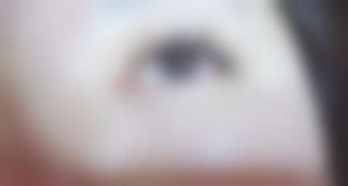 青岛洋美植发求美者反馈