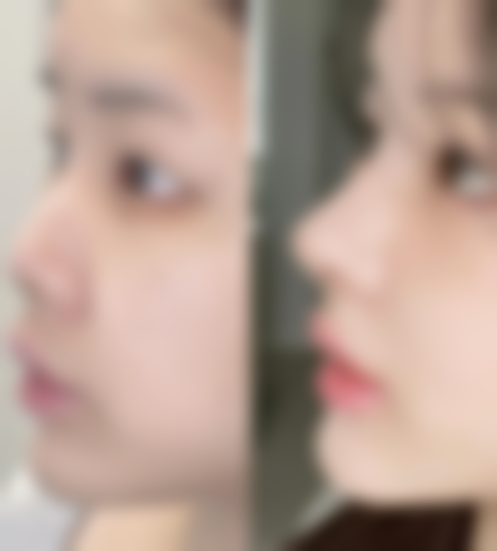 衡阳卡曼妍医疗美容诊所怎么样价格收费