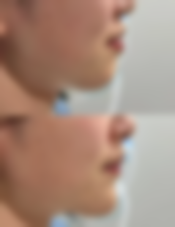 林祥的特色精细化医美服务