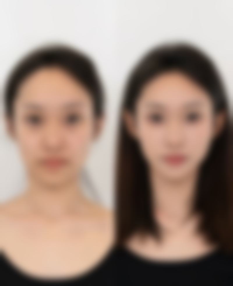 合肥白厦整形医疗美容诊所价格收费