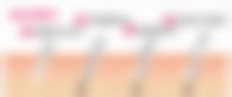 北京熙朵植发来院路线