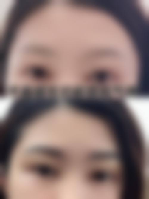 韩国本思皮肤科新沙店价格收费