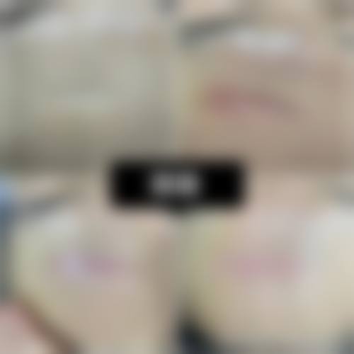 焦作市第二人民医院烧伤整形科求美者反馈