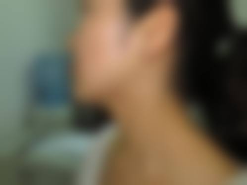 张盛波医生团队的专精技术优势