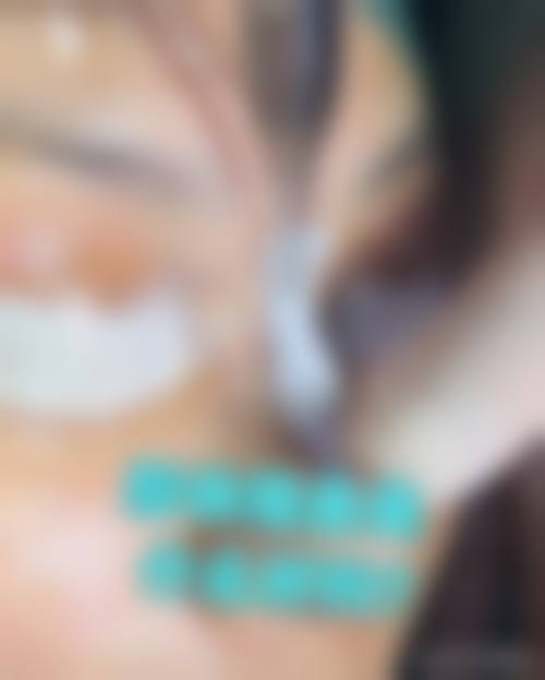 胡晗菲医师坚持个性化定制,打造专属美丽方案