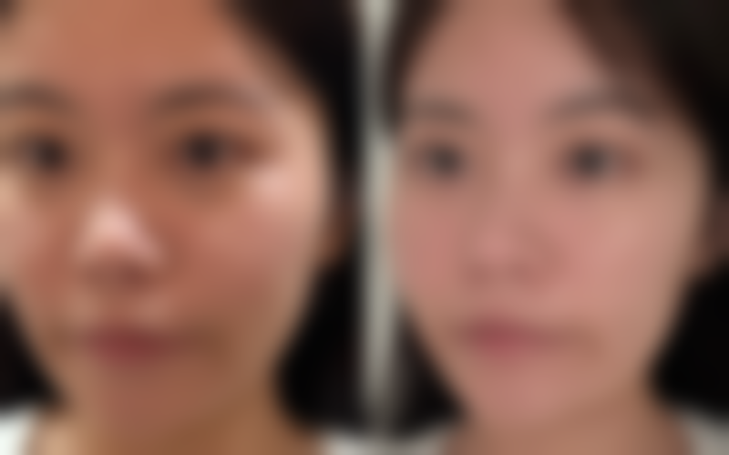 天津市公安医院美容科价格收费