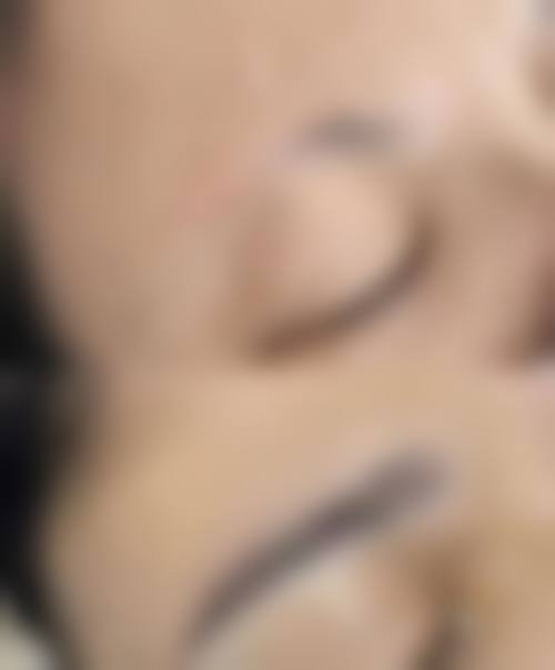 洛阳盛初未毛植发医院价格收费