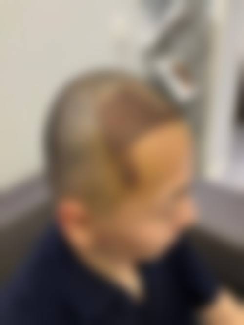 如何预约陈光平院长的面诊服务