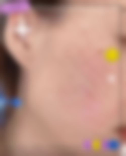 昆明吴氏嘉美美容整形医院价格收费