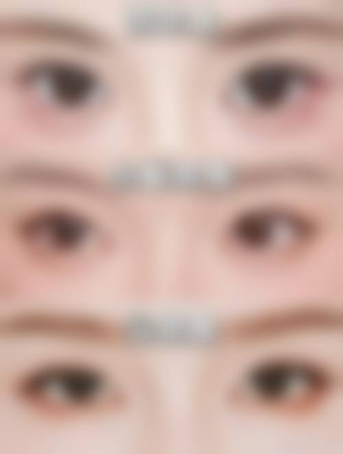 孝感天妃整形求美者反馈