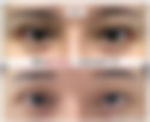 孝感天妃整形来院路线