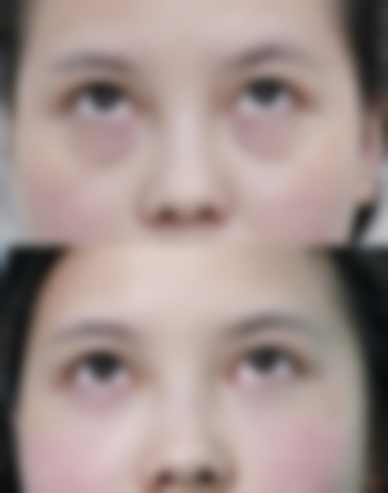 常德瑞美医疗美容外科诊所求美者反馈