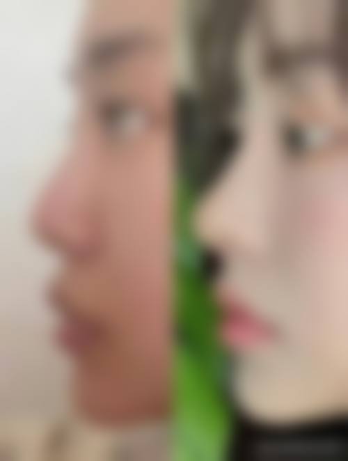 郑州美奈尔医疗美容医院价格收费