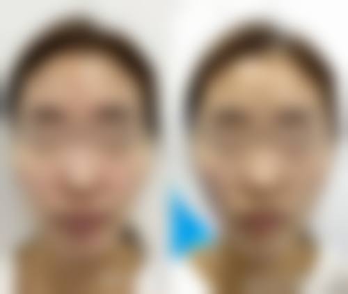 呼和浩特维科美容整形诊所求美者反馈