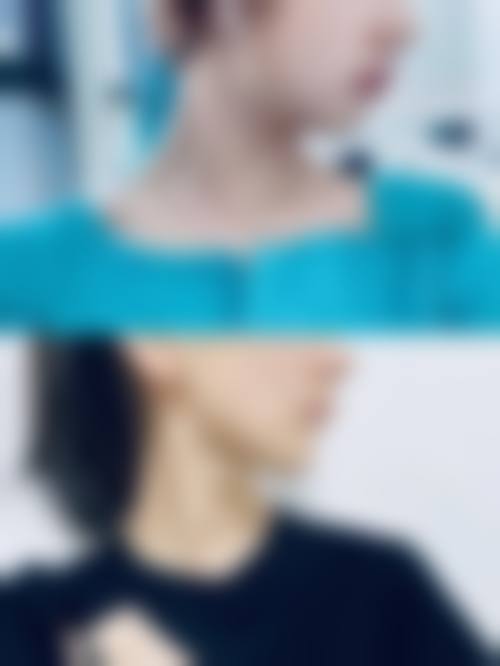 韩国AB整形外科求美者反馈