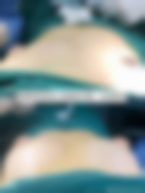 王冰院长：23年注射微整形的面部年轻化骨干医生