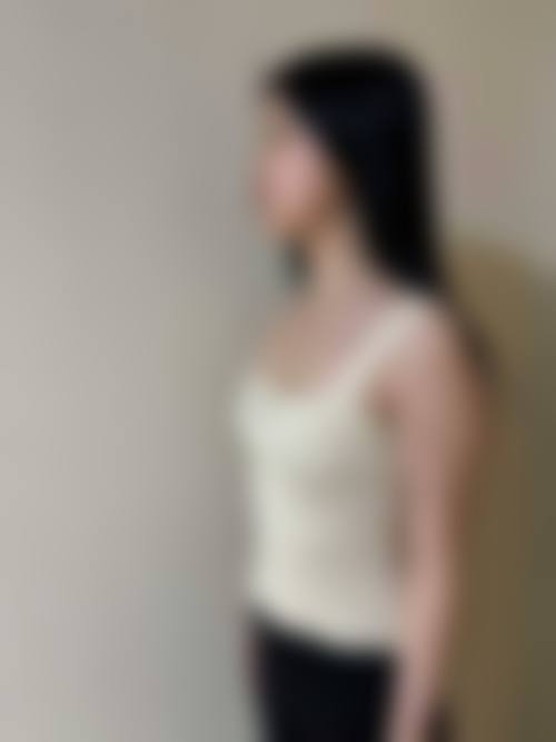 宁波卓美整形求美者反馈