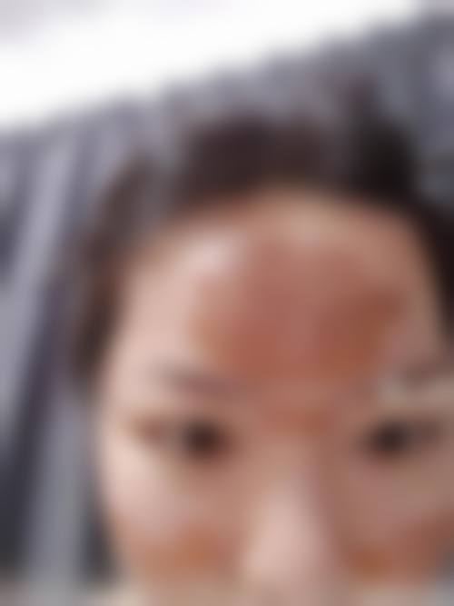 乐山美诺拉医疗美容门诊部求美者反馈