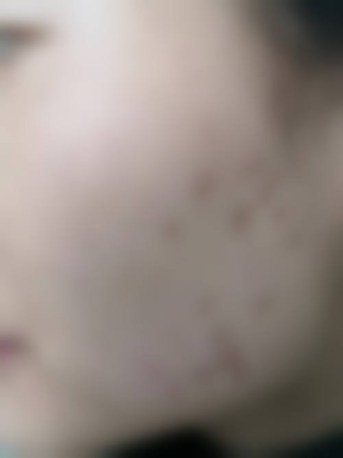 孝感中 心医院整形烧伤外科来院路线