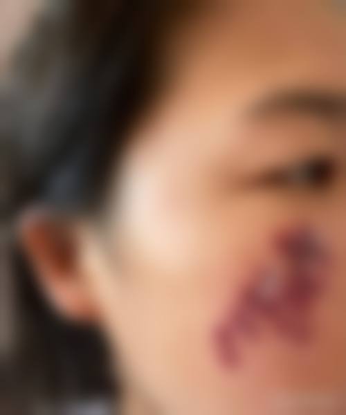 孝感中 心医院整形烧伤外科医生团队实力