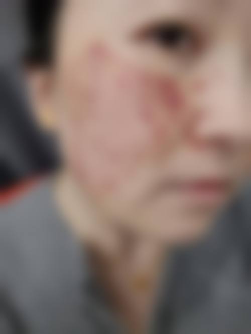 孝感中 心医院整形烧伤外科基本信息