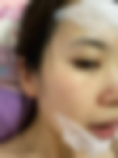 孝感中 心医院整形烧伤外科求美者反馈